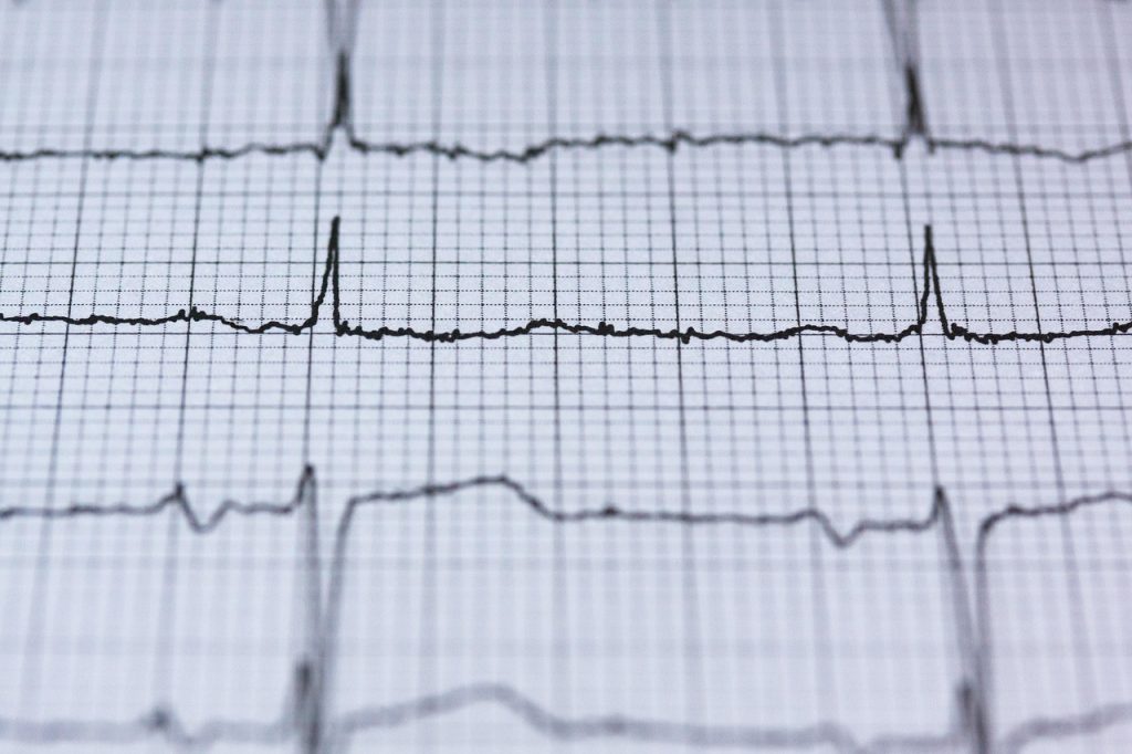 Ecg, electrocardiogram, medicine — Understanding the Benefits of Buying Intex Pharma Products