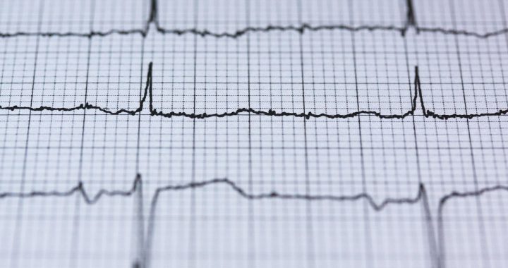 Ecg, electrocardiogram, medicine — Understanding the Benefits of Buying Intex Pharma Products